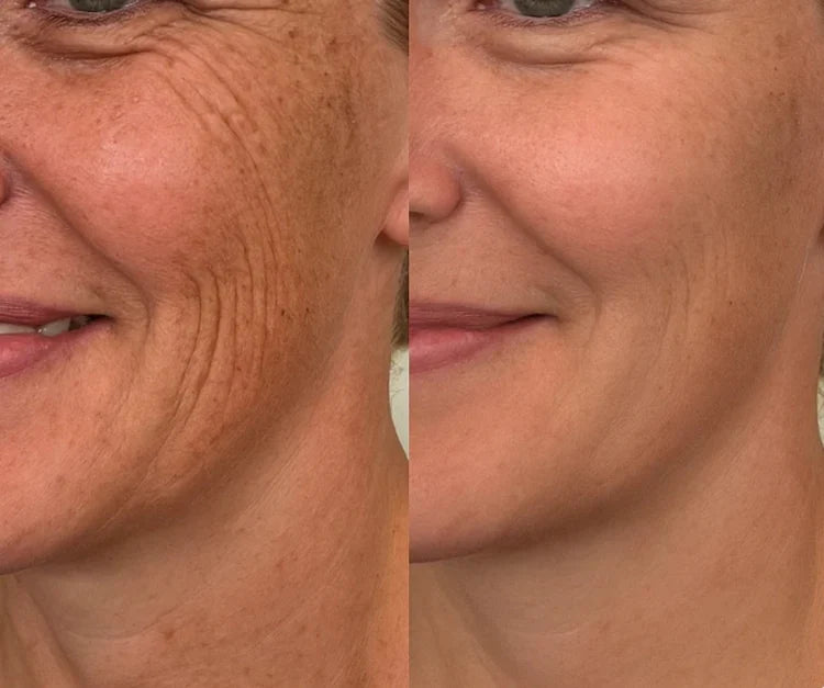 Silicone Scar Sheets | Wake Up to Smoother Skin and a Appearance That Looks 5 Years Younger