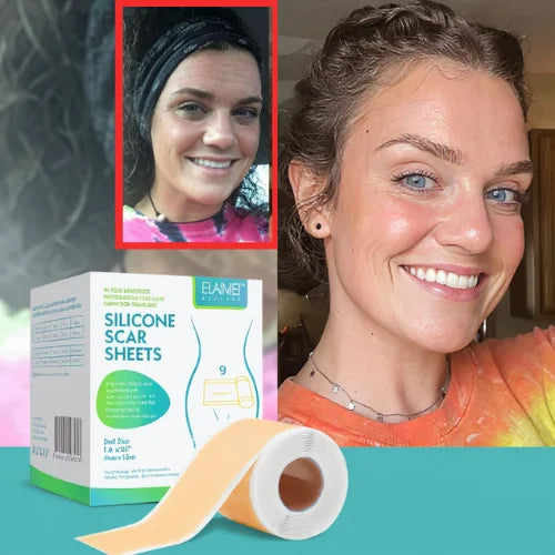Silicone Scar Sheets | Wake Up to Smoother Skin and a Appearance That Looks 5 Years Younger